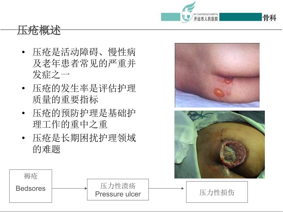 壓瘡分級最新標準,壓瘡分級最新標準的深度論述